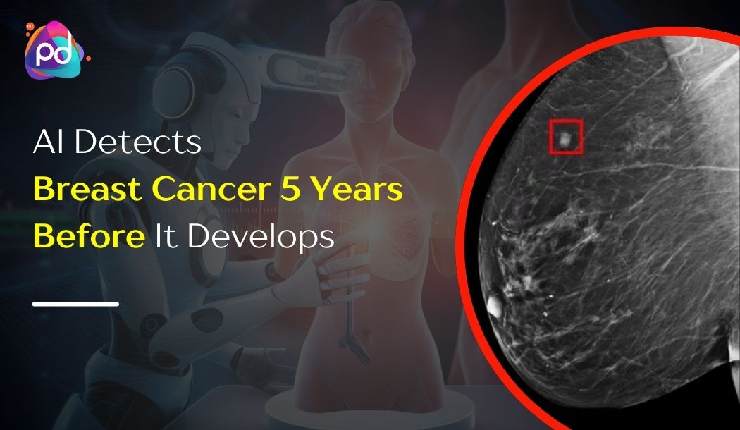 AI Detects Breast Cancer 5 Years Before It Develops