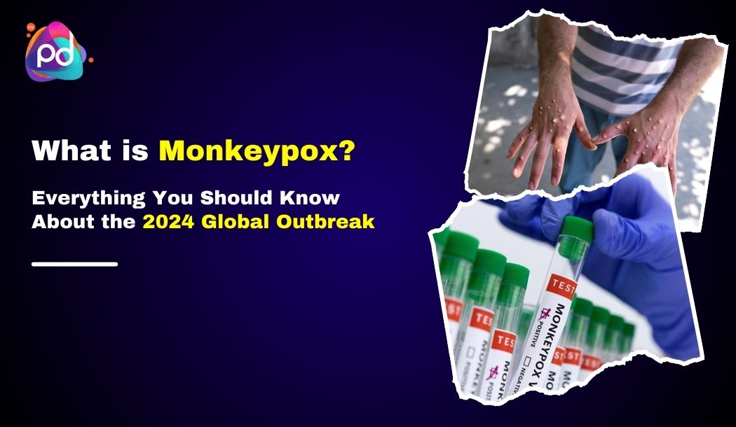 What is Monkeypox? Everything You Should Know About the 2024 Global Outbreak
